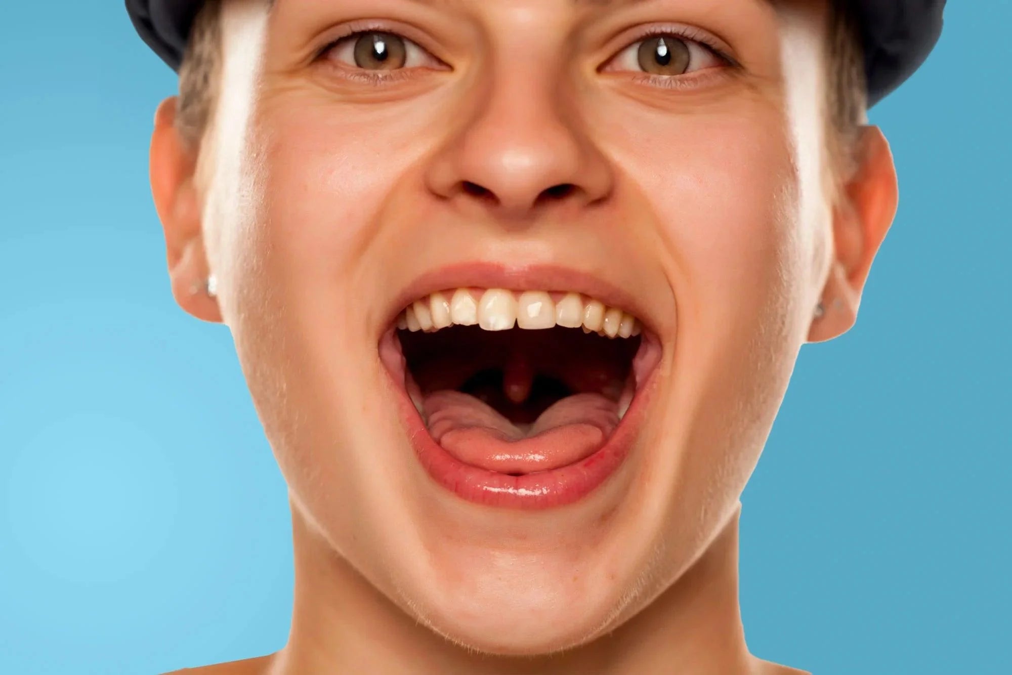 Hydropulseur caséum