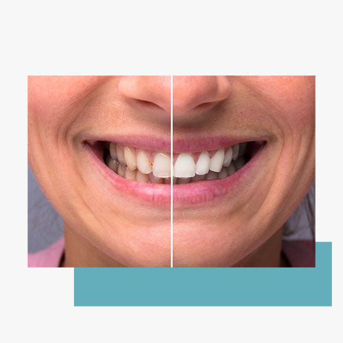 Nettoyage en profondeur avant après - monhydropulseur.fr